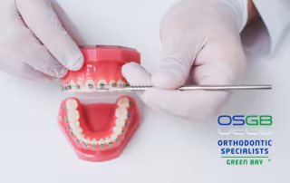 braces