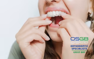 woman with clear aligners