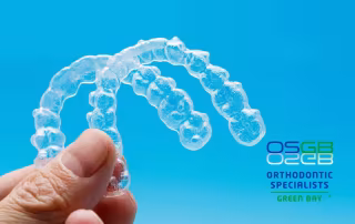 clear aligners