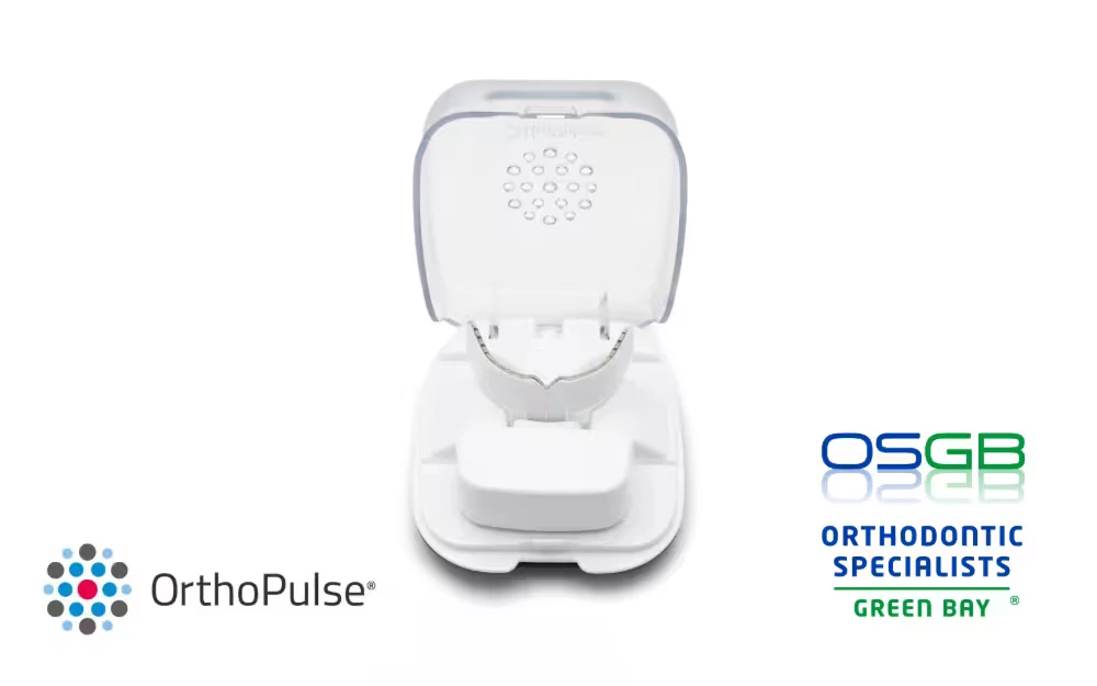 OrthoPulse Faster, Comfortable Orthodontic Treatment